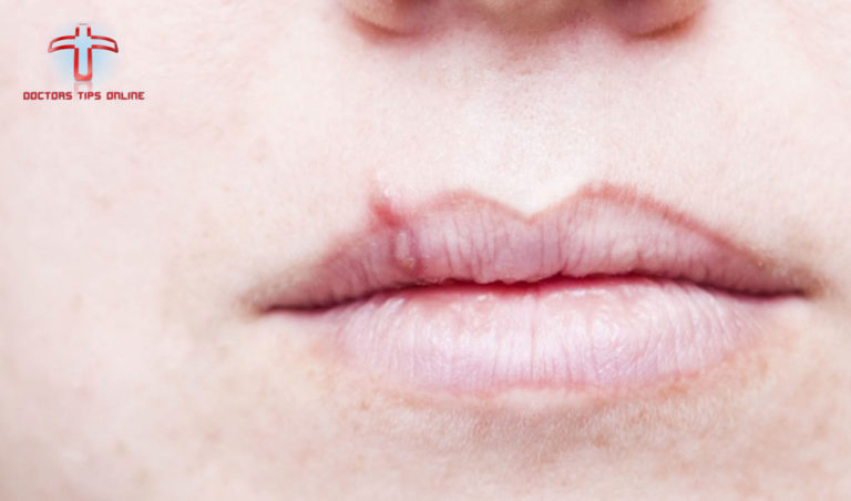 White Bumps Under Skin On Lips