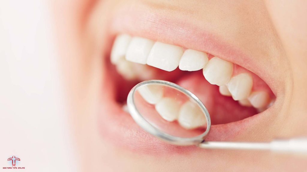 white-marks-on-teeth-in-adults-archives-doctors-tips-online